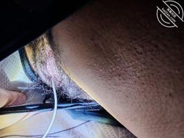 《真实原创》晚上趁老婆睡着,把玩老婆的骚穴2