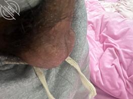 蛋蛋越大装的越多吗？1