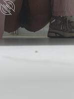 早起的鸟儿有虫吃，一大早就有惊喜厕拍0