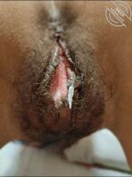 帮忙看下老婆的下面是处女么，是不是被干过0