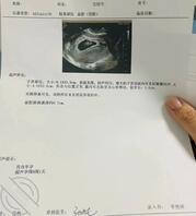 希望天下母子好结果0