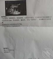 老婆怀孕了，这段时间操不了了，不知道孩子是在座的哪一位的。