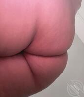 不止痒啊这0