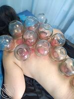 高挑美女来拔罐1