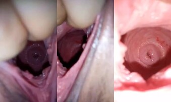 夫妻原创，看看骚逼内部结构。