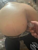 记录(25)妈妈最近便秘,帮妈妈上开塞露2