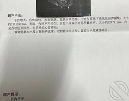 【真实原创】171、婶婶怀孕了,这个夏天突然感觉有些冷1