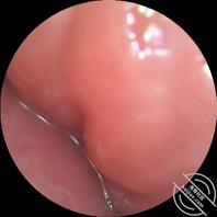 【家庭真实系列】内窥镜探索老婆淫穴内部结构1