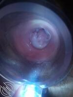 熟女骚妻的高清子宫，把她丝袜脱下来塞进她的子宫2