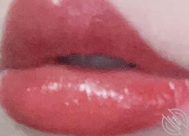 舌吻