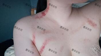 刮了个痧好像经历了什么不得了的事情