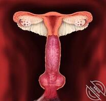 乱伦怀孕要生下来吗？0