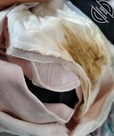 我妹好像被干出病了,逼里有分泌物把内裤都搞变色了还闻着味道好骚1